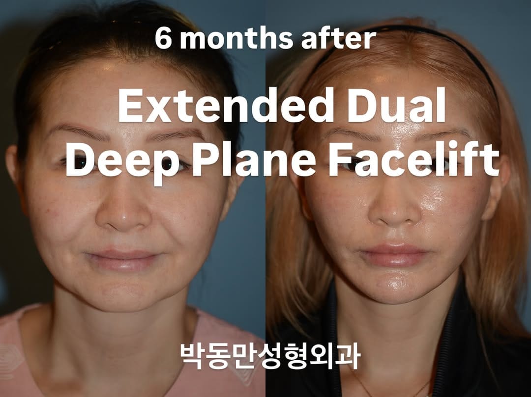 Post 7 by PDM Plastic Surgery Clinic on Instagram (image)