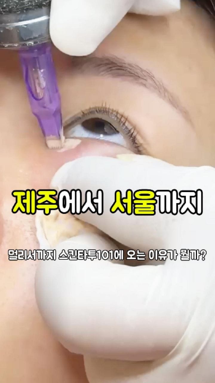 Post 8 by 눈밑지방재배치 눈밑 눈밑꺼짐  다크서클반영구 다크서클커버 대구타투  헤나 기미타투  기미제거 기미크림 다크서클 on Instagram (video)