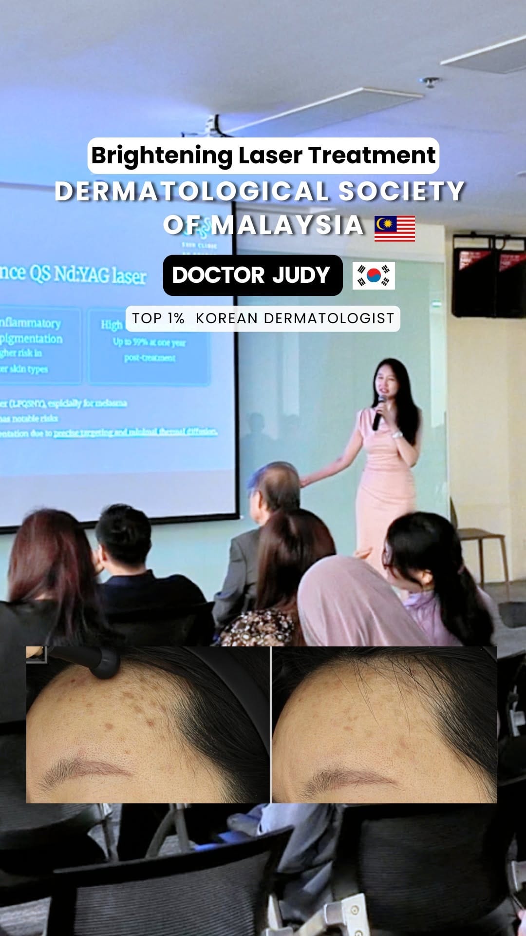 Post 7 by GLASSY SKIN CLINIC Seoul 🇰🇷 by Dr. JUDY & Dr. ERIC 청담글래시피부과 on Instagram (video)