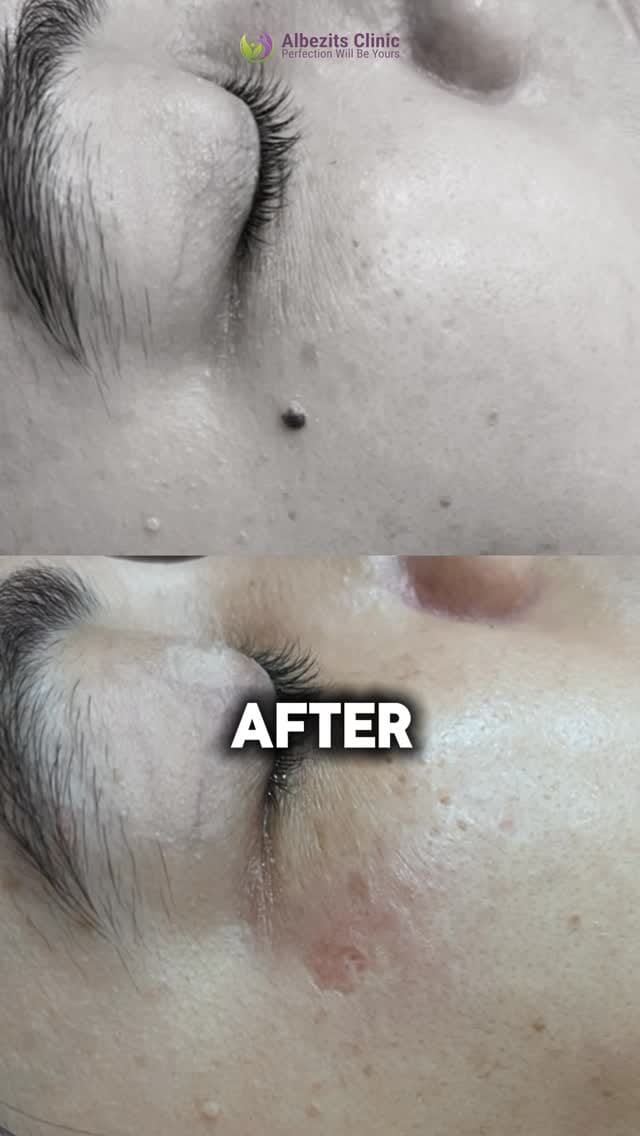 Post 7 by Albezits Clinic - Gold on Instagram (video)