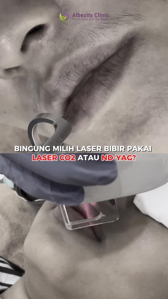 Post 8 by Albezits Clinic - Gold on Instagram (video)