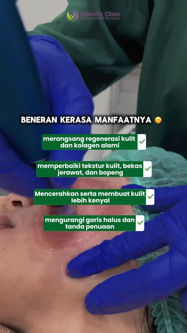 Post 6 by Albezits Clinic - Gold on Instagram (video)