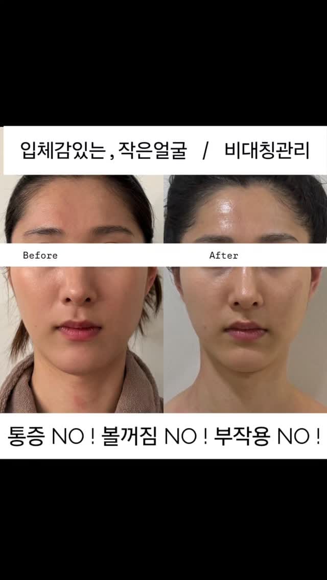 Post 9 by 관리의 전 후 차이를 보여주는 전문적인  건강미대구점 ㅣ산전산후 ㅣ웨딩관리 ㅣ 작은얼굴 ㅣ림프마사지 on Instagram (video)