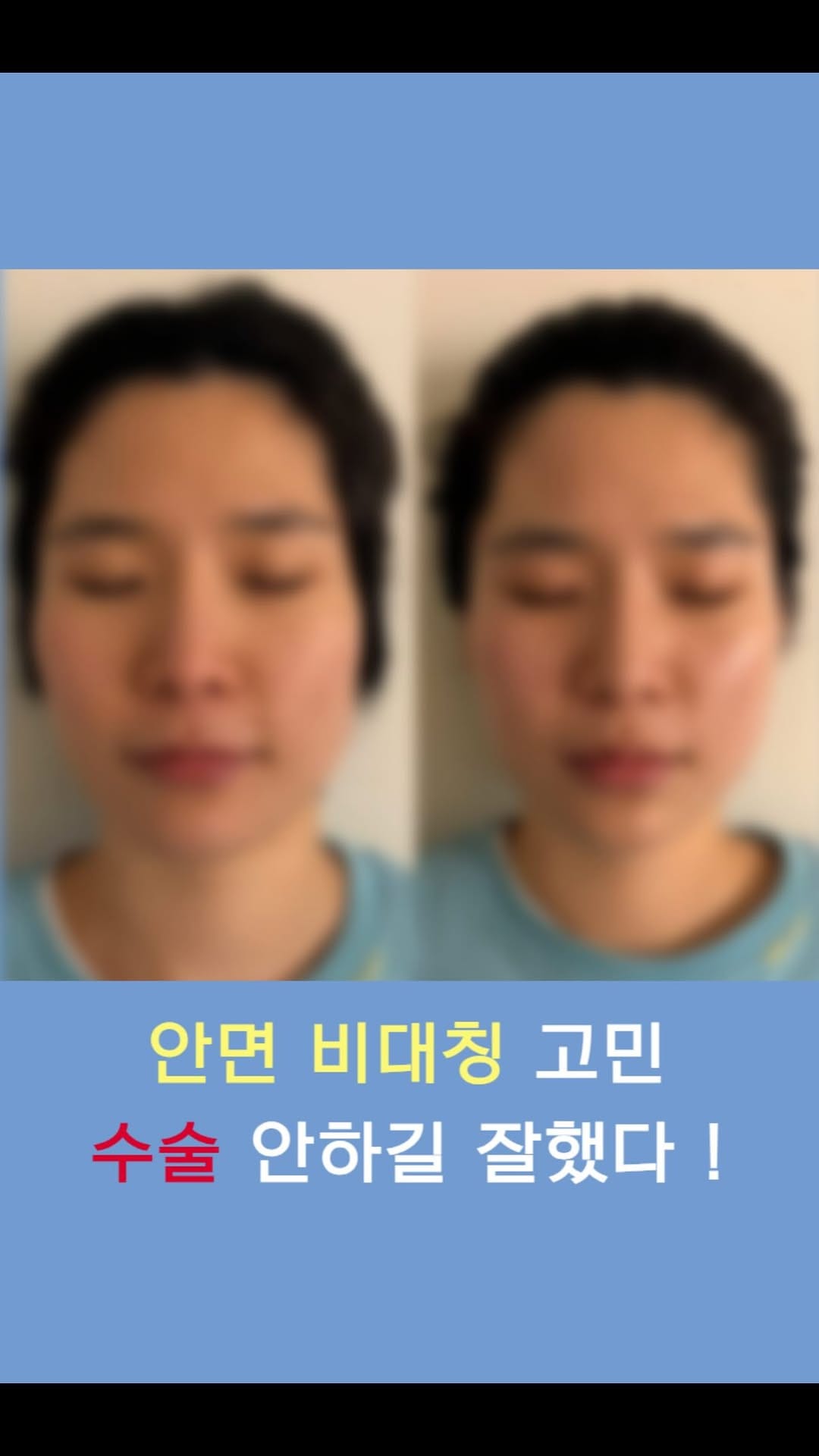 Post 4 by 🇰🇷 대한민국 1등ㅣ비대칭 전문ㅣ건강미 스파 청담 잠실 on Instagram (video)