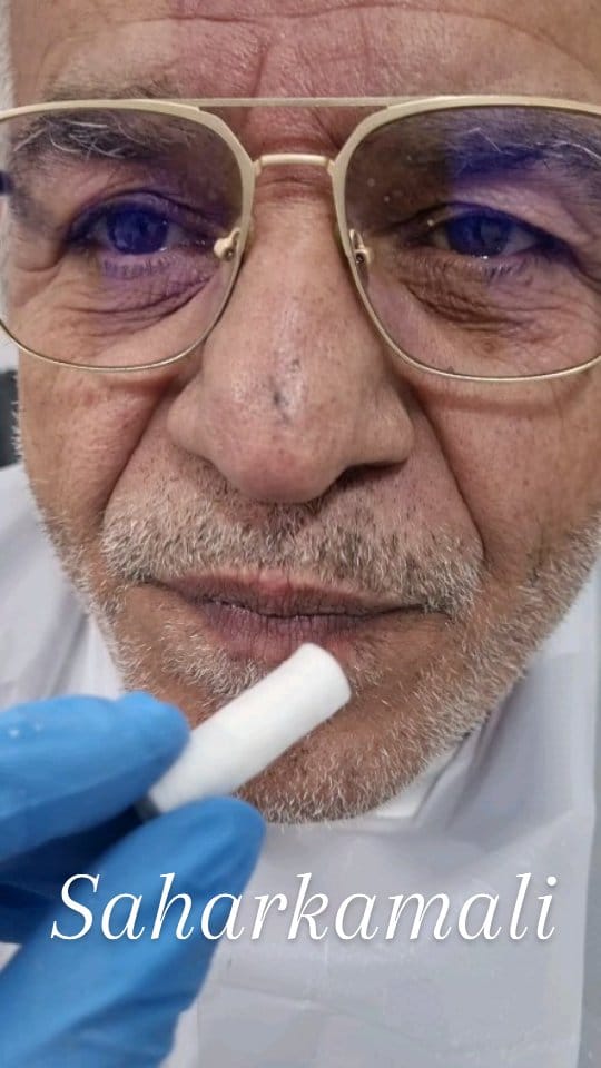 Post 8 by سحر کمالی🦷Saharkamali🌍akodentall on Instagram (video)