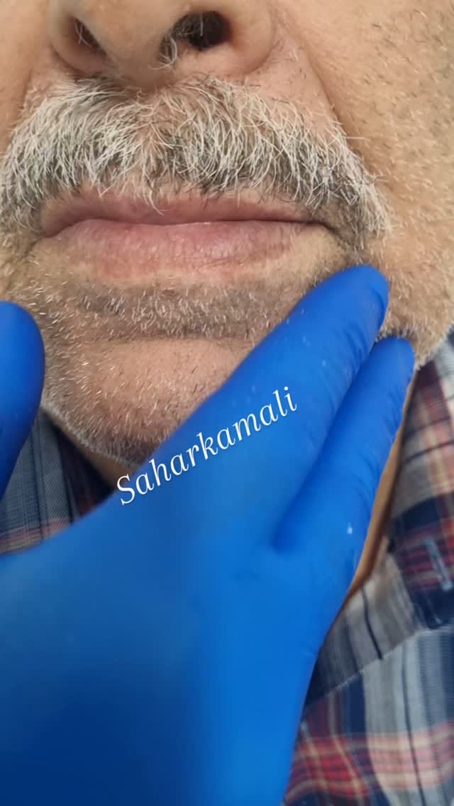 Post 9 by سحر کمالی🦷Saharkamali🌍akodentall on Instagram (video)