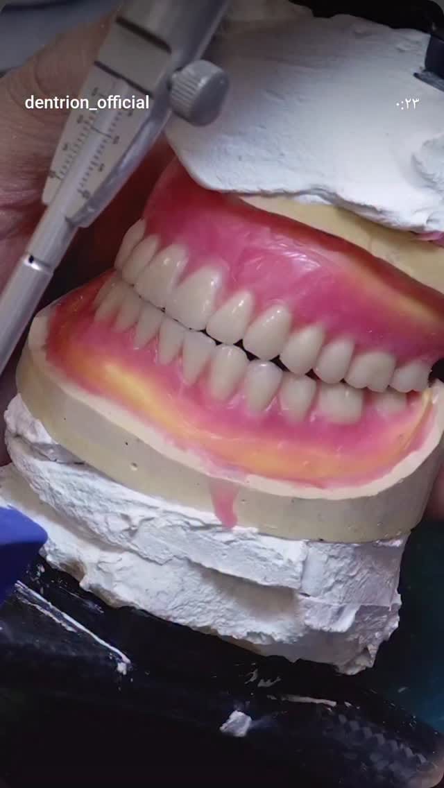 Post 1 by سحر کمالی🦷Saharkamali🌍akodentall on Instagram (video)