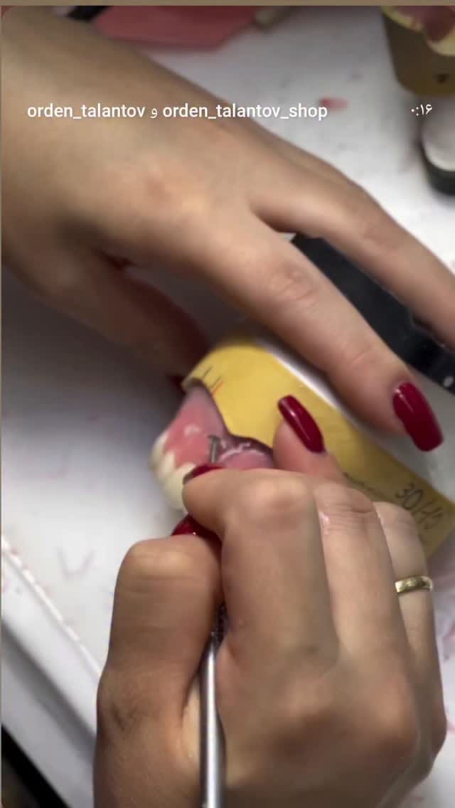 Post 7 by سحر کمالی🦷Saharkamali🌍akodentall on Instagram (video)