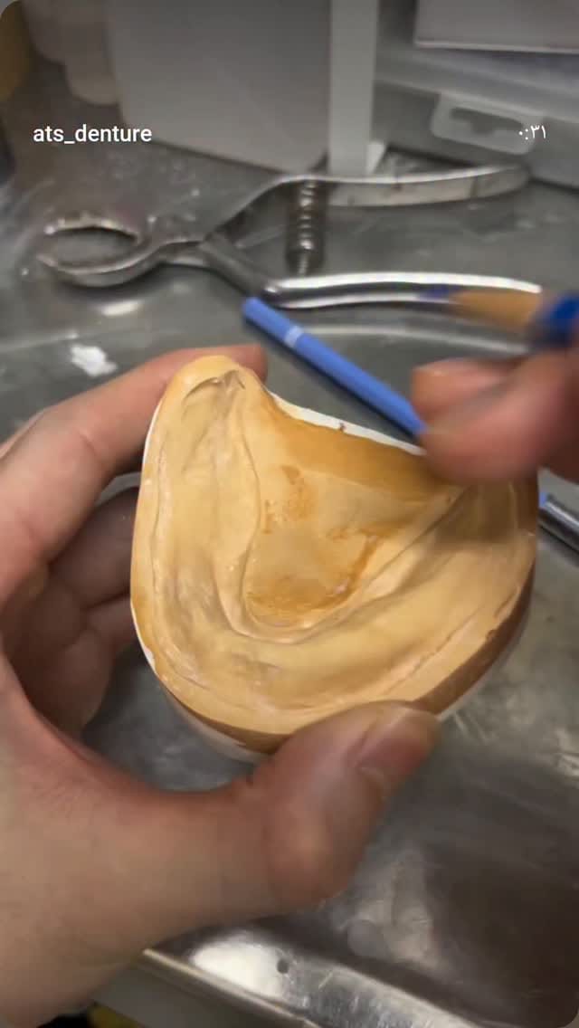 Post 4 by سحر کمالی🦷Saharkamali🌍akodentall on Instagram (video)