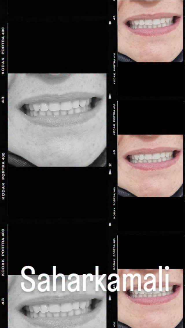 Post 6 by سحر کمالی🦷Saharkamali🌍akodentall on Instagram (video)