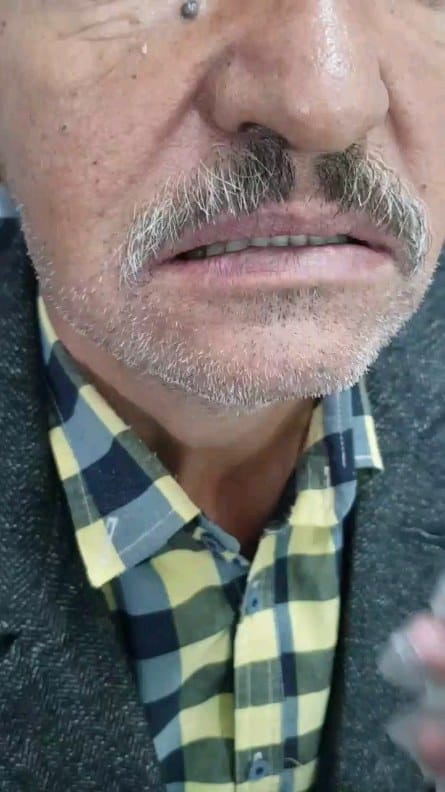 Post 10 by سحر کمالی🦷Saharkamali🌍akodentall on Instagram (video)