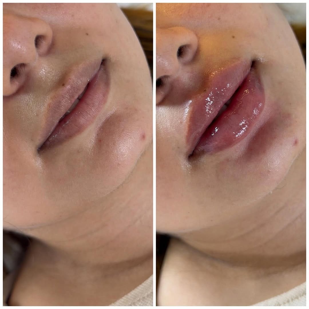 Post 1 by Bellanova Medicina Estetica on Instagram (image)