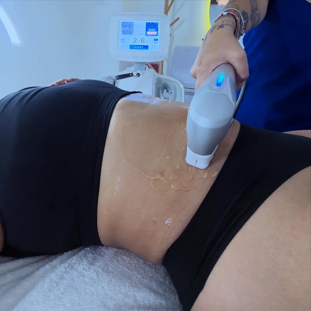Post 2 by Bellanova Medicina Estetica on Instagram (image)