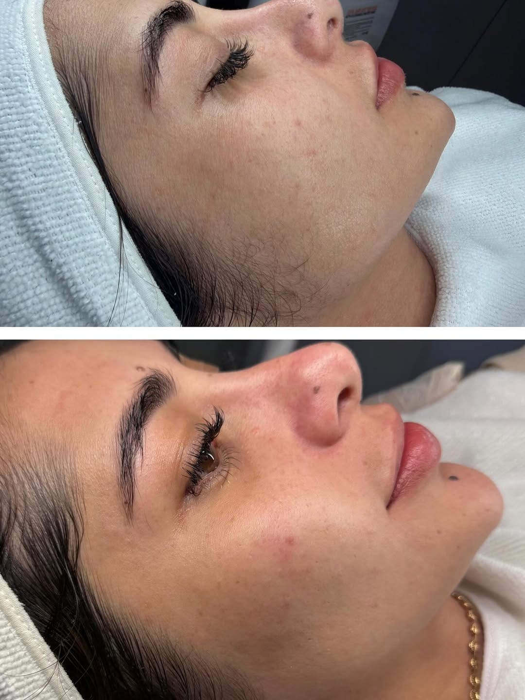 Post 4 by Bellanova Medicina Estetica on Instagram (image)