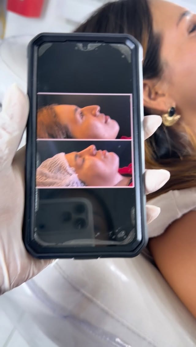 Post 6 by Bellanova Medicina Estetica on Instagram (video)