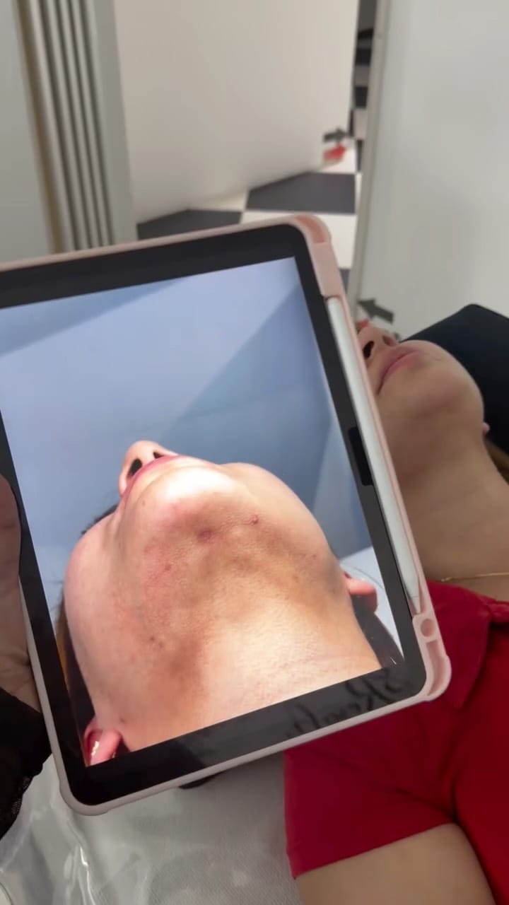 Post 3 by Bellanova Medicina Estetica on Instagram (video)