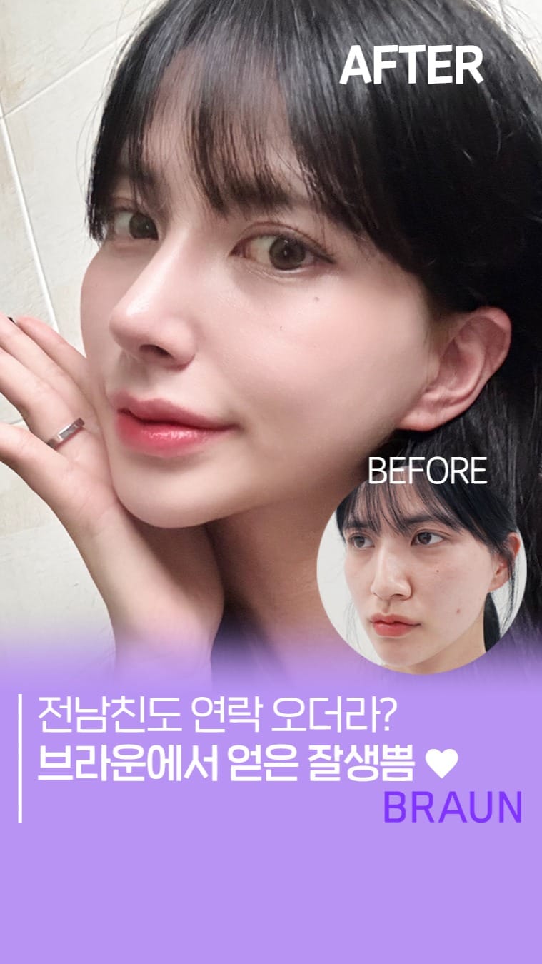 Post 2 by 브라운성형외과 on Instagram (video)