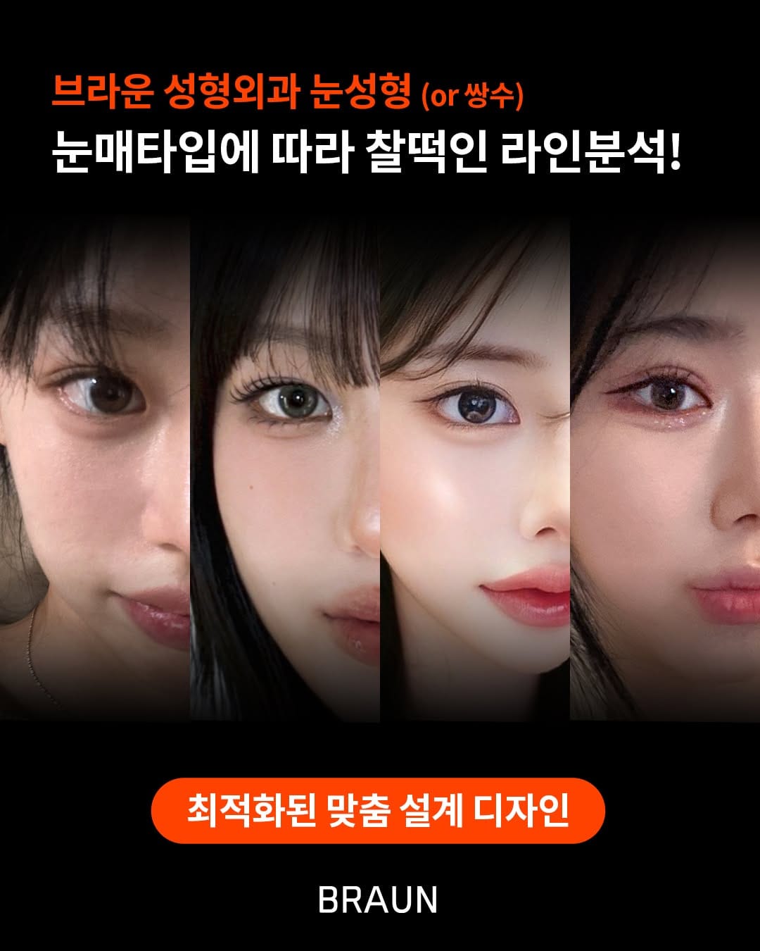 Post 9 by 브라운성형외과 on Instagram (image)