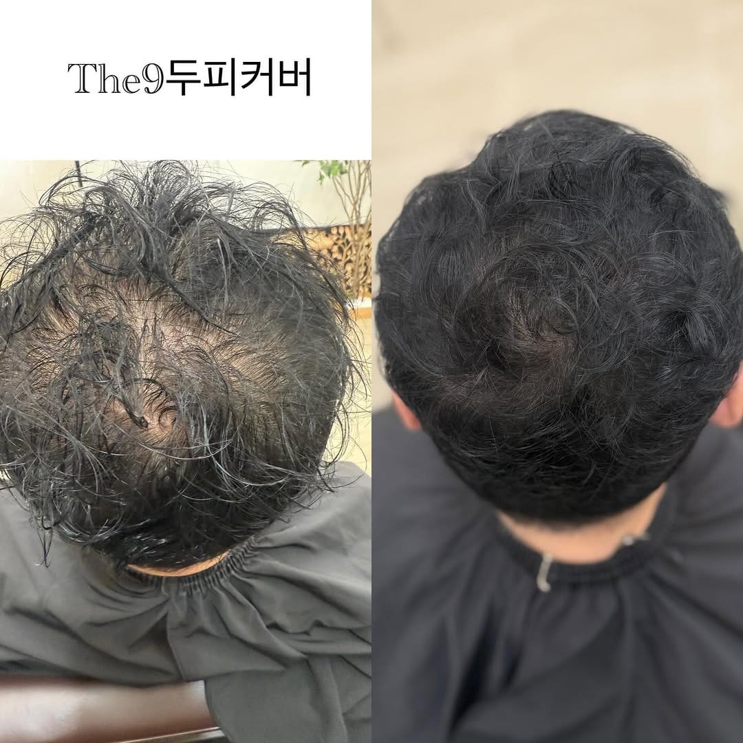 Post 1 by 튼살커버 /대구눈썹문신잘하는곳/스킨52 on Instagram (image)