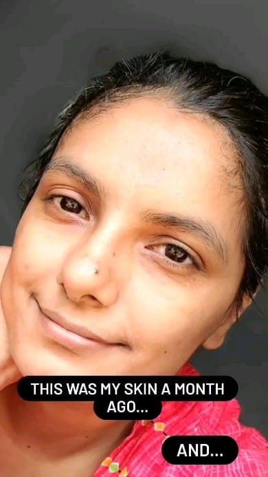 Post 10 by Shripa Aditya | Digital Creator | Skincare Enthusiast on Instagram (video)
