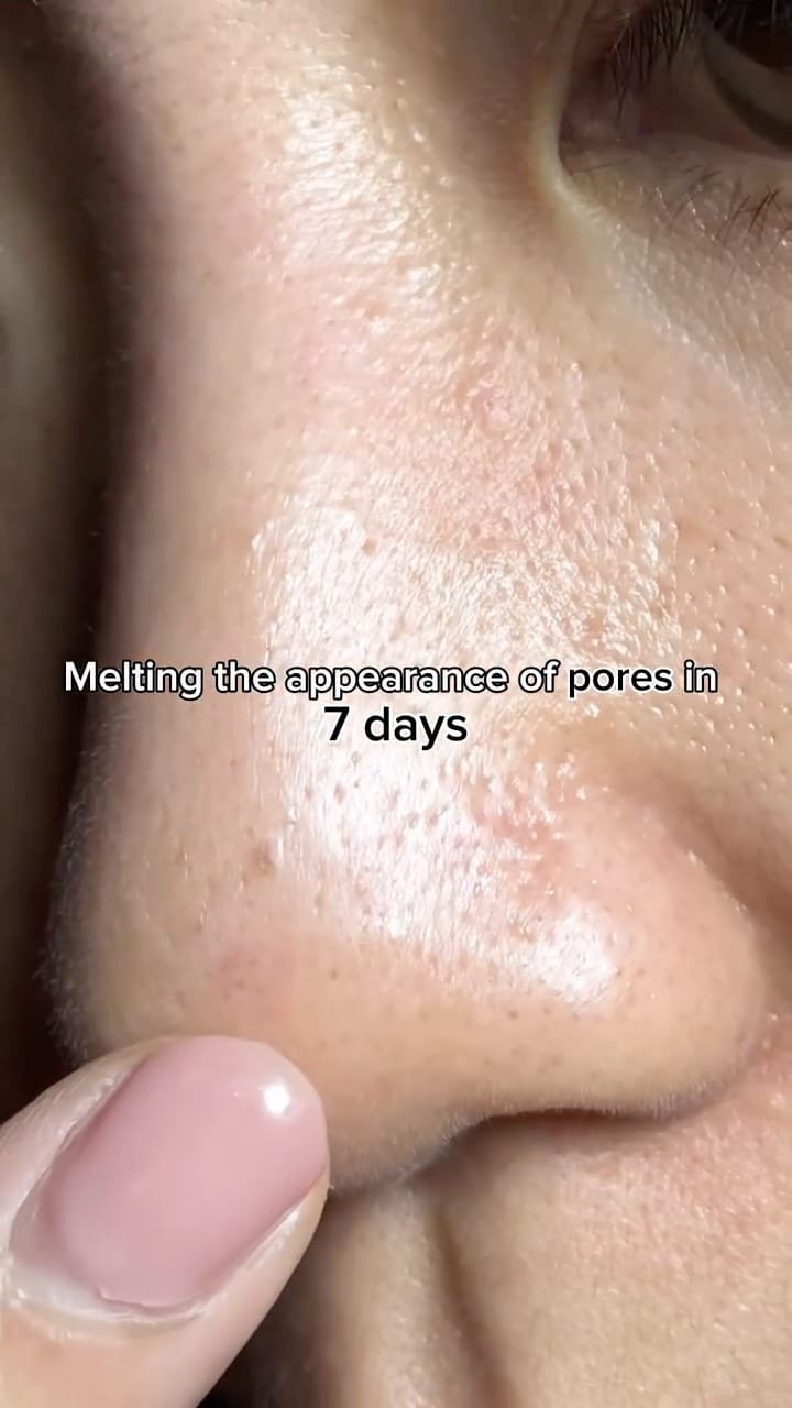 Post 9 by Glow Shelfie - Healthy skin for Beautiful souls 💓✨🐰 on Instagram (video)