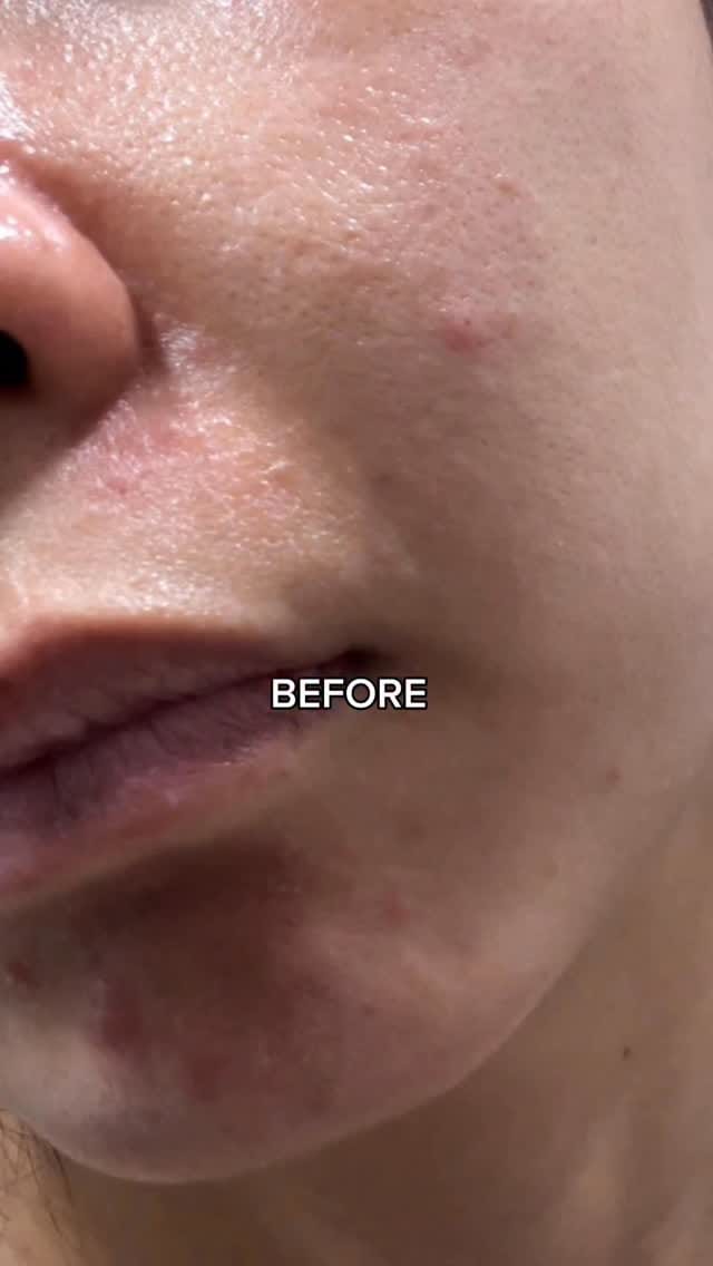 Post 3 by Glow Shelfie - Healthy skin for Beautiful souls 💓✨🐰 on Instagram (video)