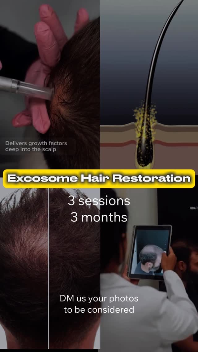 Post 3 by Marco's Derma Care on Instagram (video)