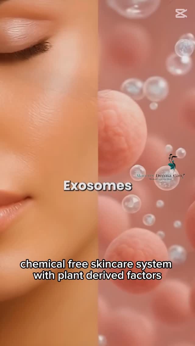Post 9 by Marco's Derma Care on Instagram (video)