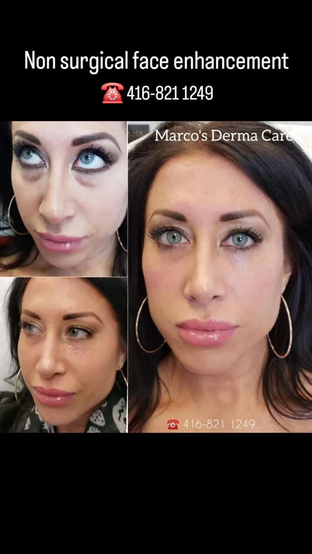 Post 6 by Marco's Derma Care on Instagram (video)