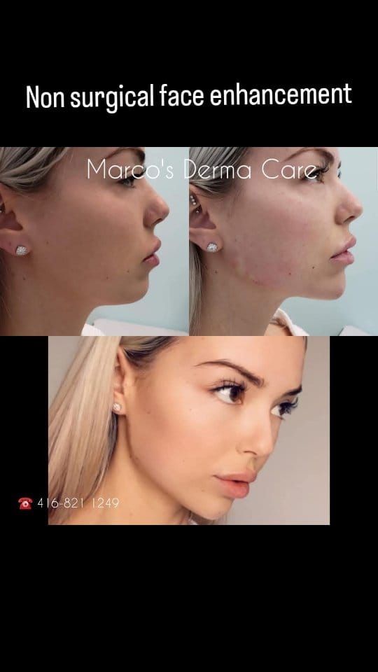 Post 7 by Marco's Derma Care on Instagram (video)