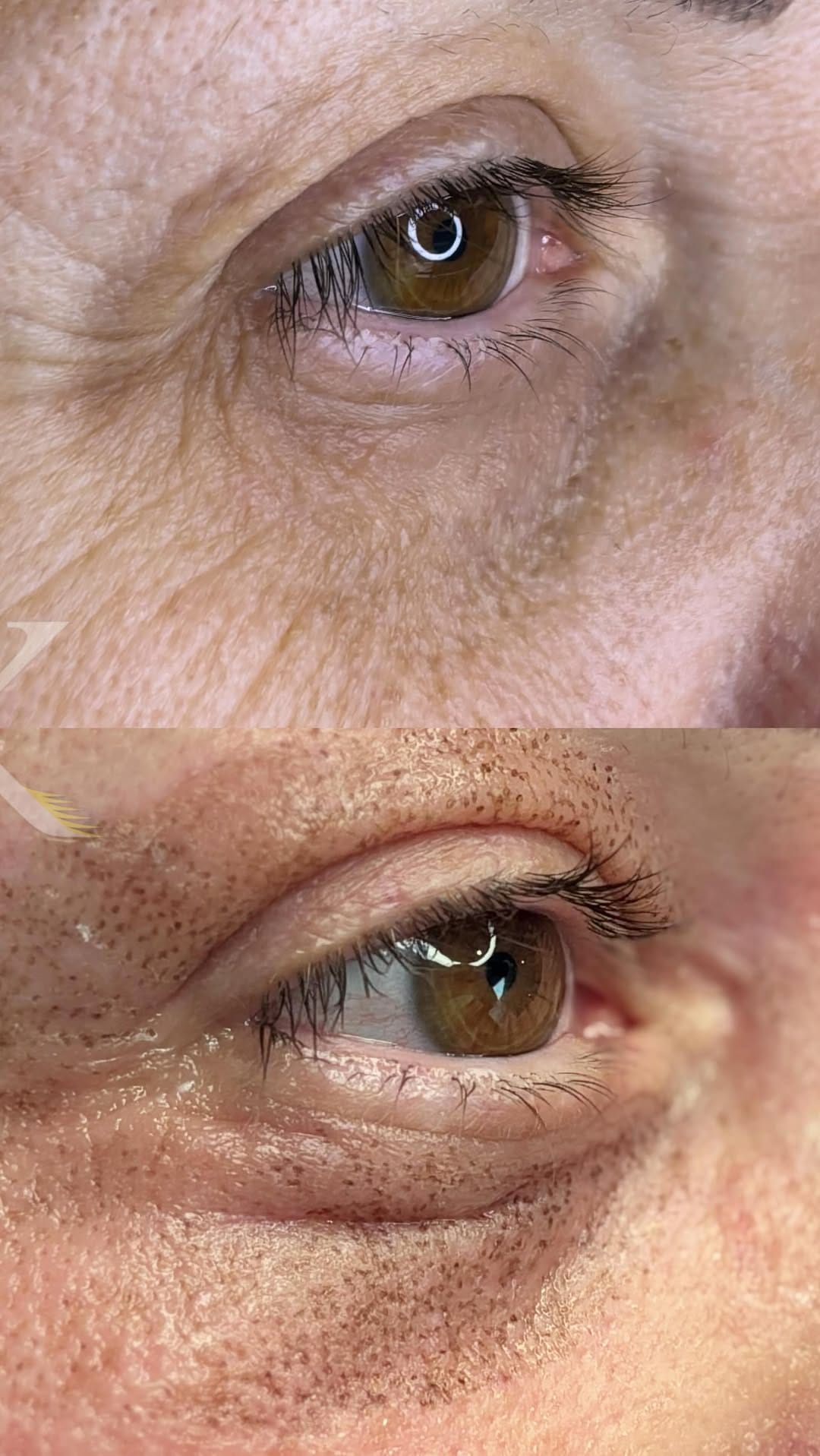 Post 4 by Marco's Derma Care on Instagram (video)