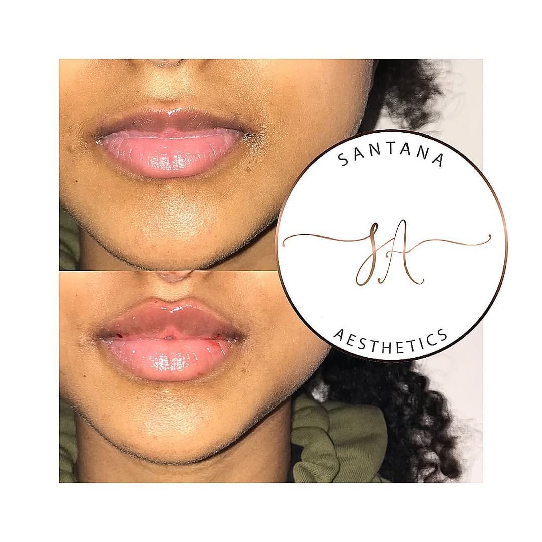 Post 1 by SANTANA AESTHETICS on Instagram (carousel)