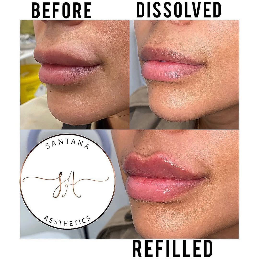 Post 10 by SANTANA AESTHETICS on Instagram (carousel)