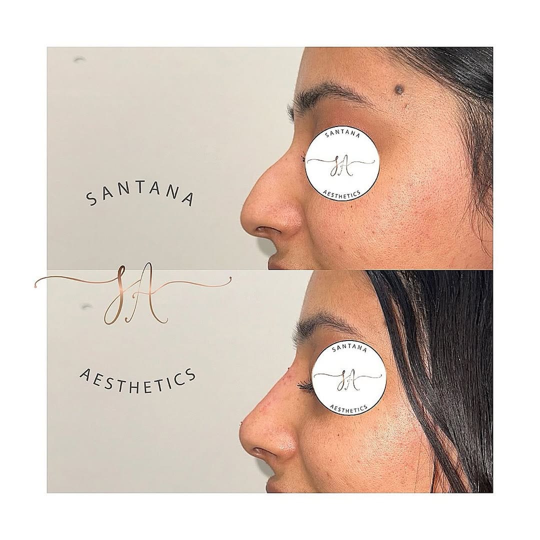 Post 3 by SANTANA AESTHETICS on Instagram (image)