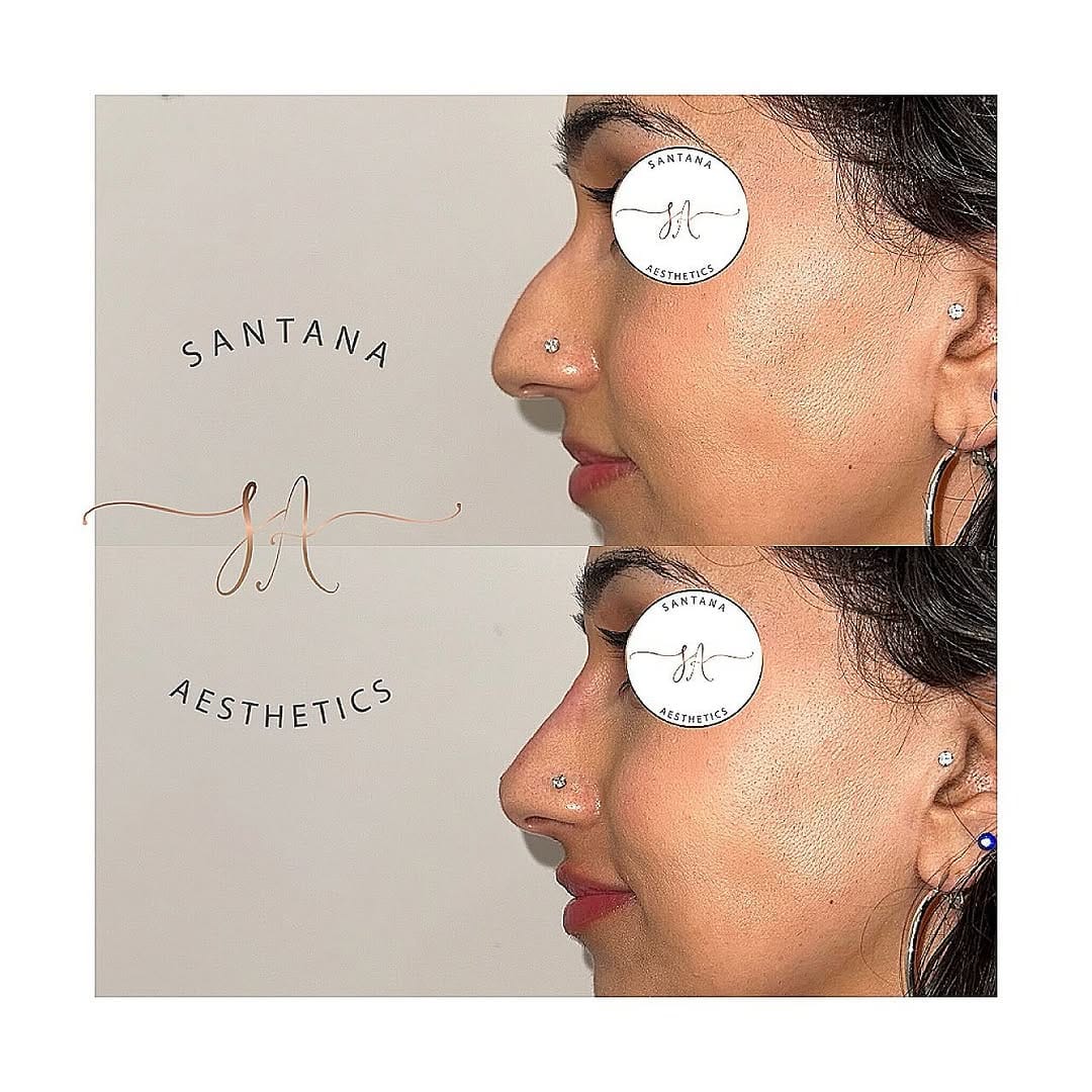Post 5 by SANTANA AESTHETICS on Instagram (image)