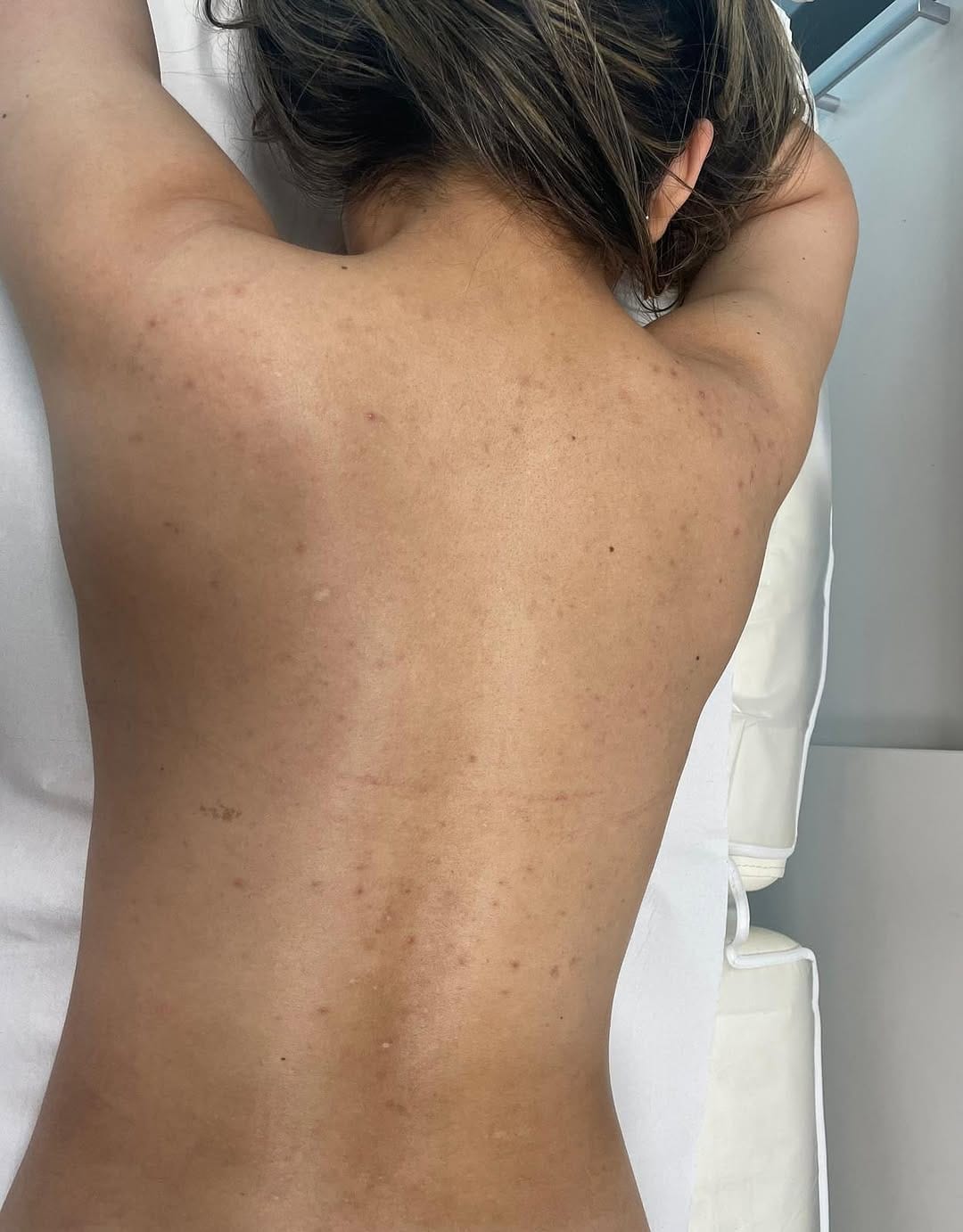 Post 5 by Laser & Skin Clinic Manchester on Instagram (carousel)