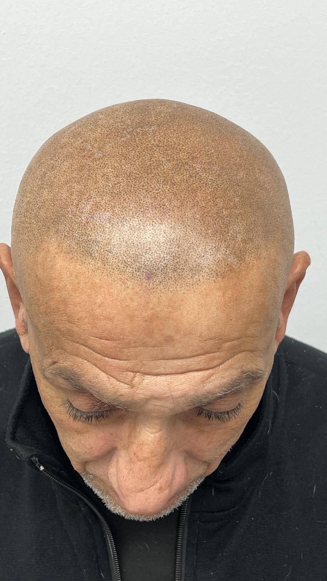 Post 4 by Scalpology on Instagram (video)