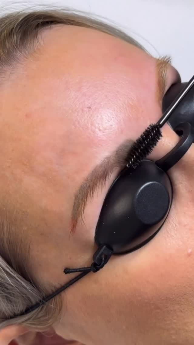 Post 8 by ᴍᴇᴅɪᴘᴀʀᴋ ᴀᴇsᴛʜᴇᴛɪᴄ & ʙᴇᴀᴜᴛʏ ᴄʟɪɴɪᴄ on Instagram (video)