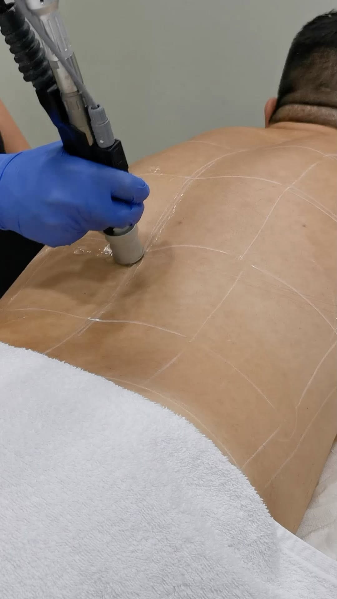 Post 9 by DermaLaser Beauty Lounge on Instagram (video)