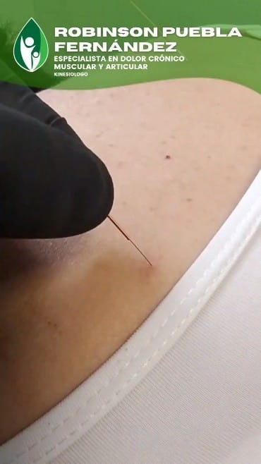 Post 6 by Kinesiólogo Robinson Puebla on Instagram (video)