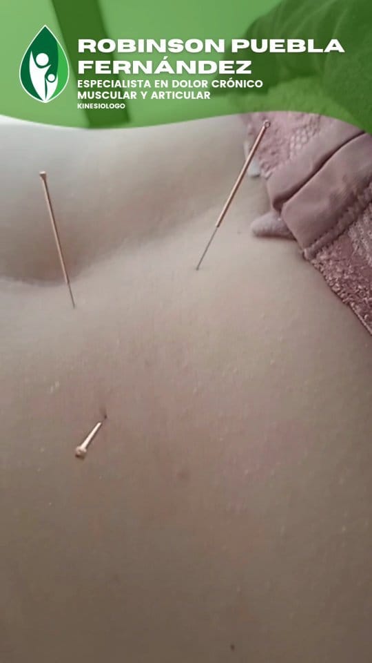 Post 8 by Kinesiólogo Robinson Puebla on Instagram (video)
