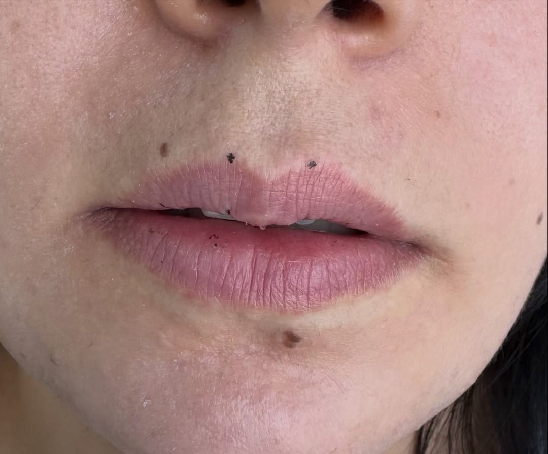 Post 3 by Uz.Dr. Sedef Yücel-Dermatolog on Instagram (carousel)