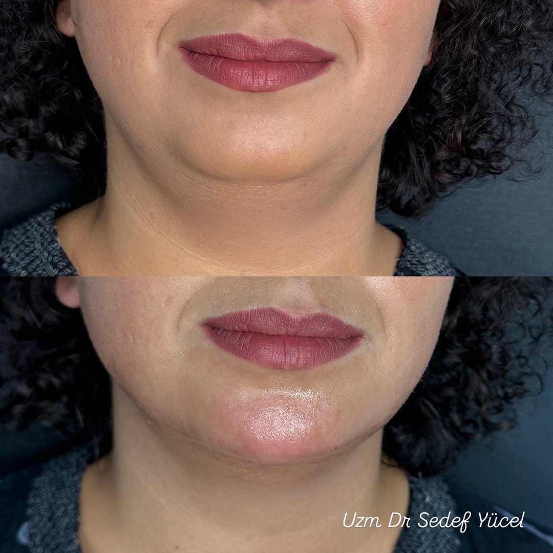 Post 5 by Uz.Dr. Sedef Yücel-Dermatolog on Instagram (image)