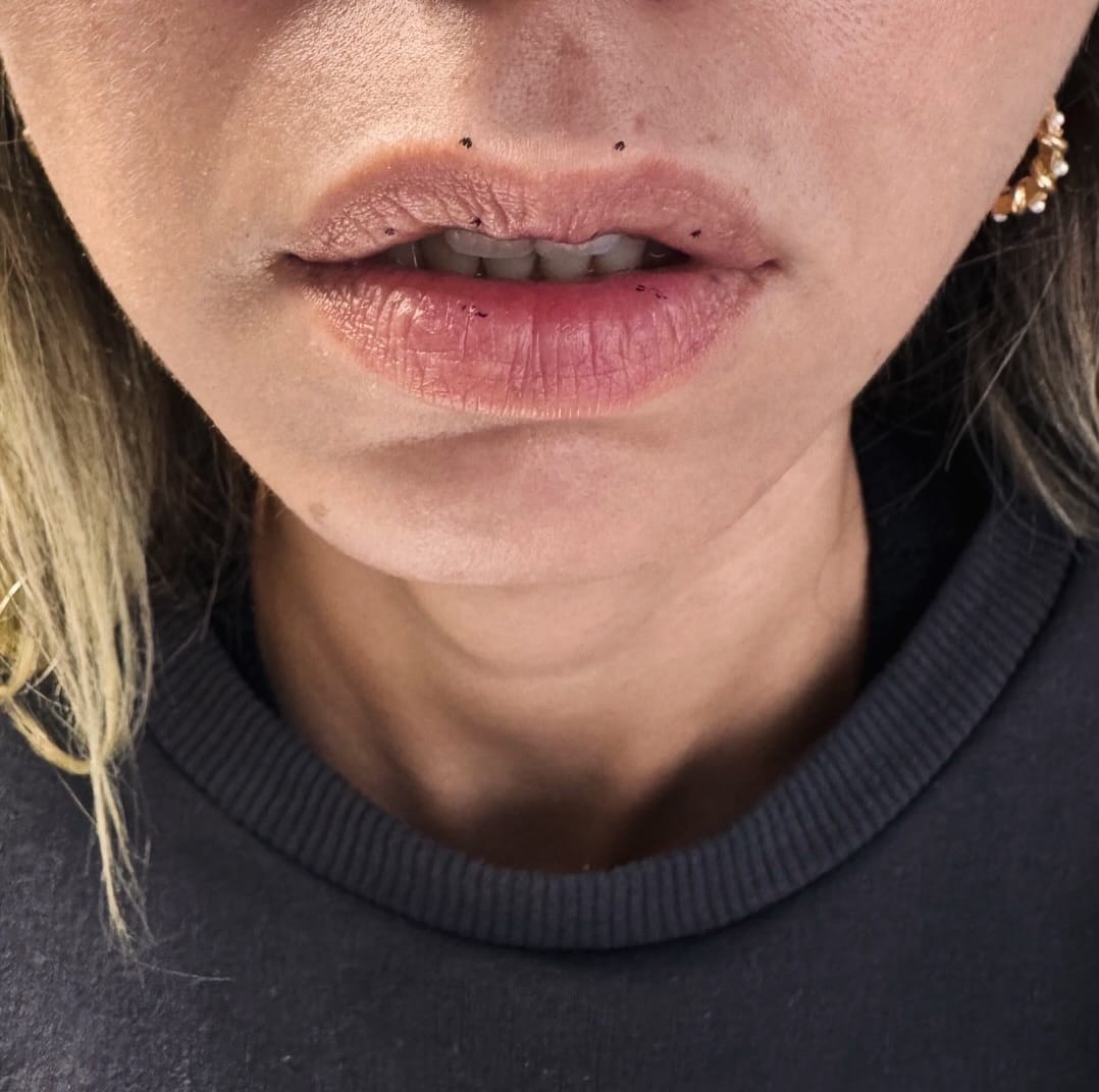 Post 7 by Uz.Dr. Sedef Yücel-Dermatolog on Instagram (carousel)