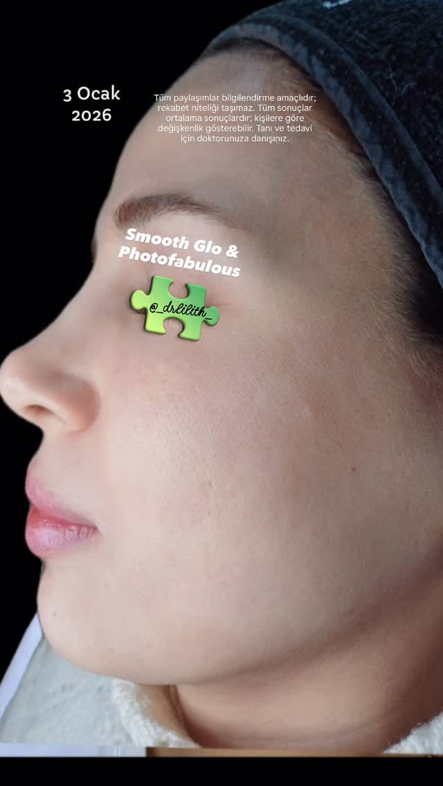 Post 3 by Dr. Bahar Baba on Instagram (video)