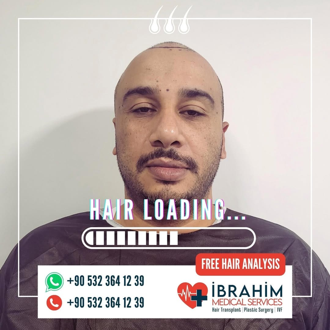 Post 10 by İbrahim Ayyıldız on Instagram (image)