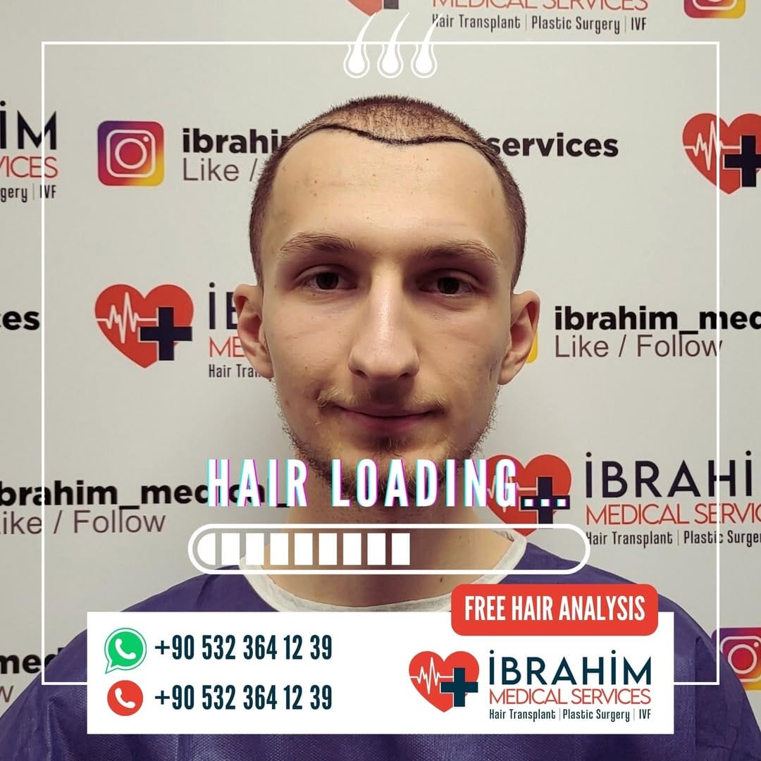 Post 7 by İbrahim Ayyıldız on Instagram (image)