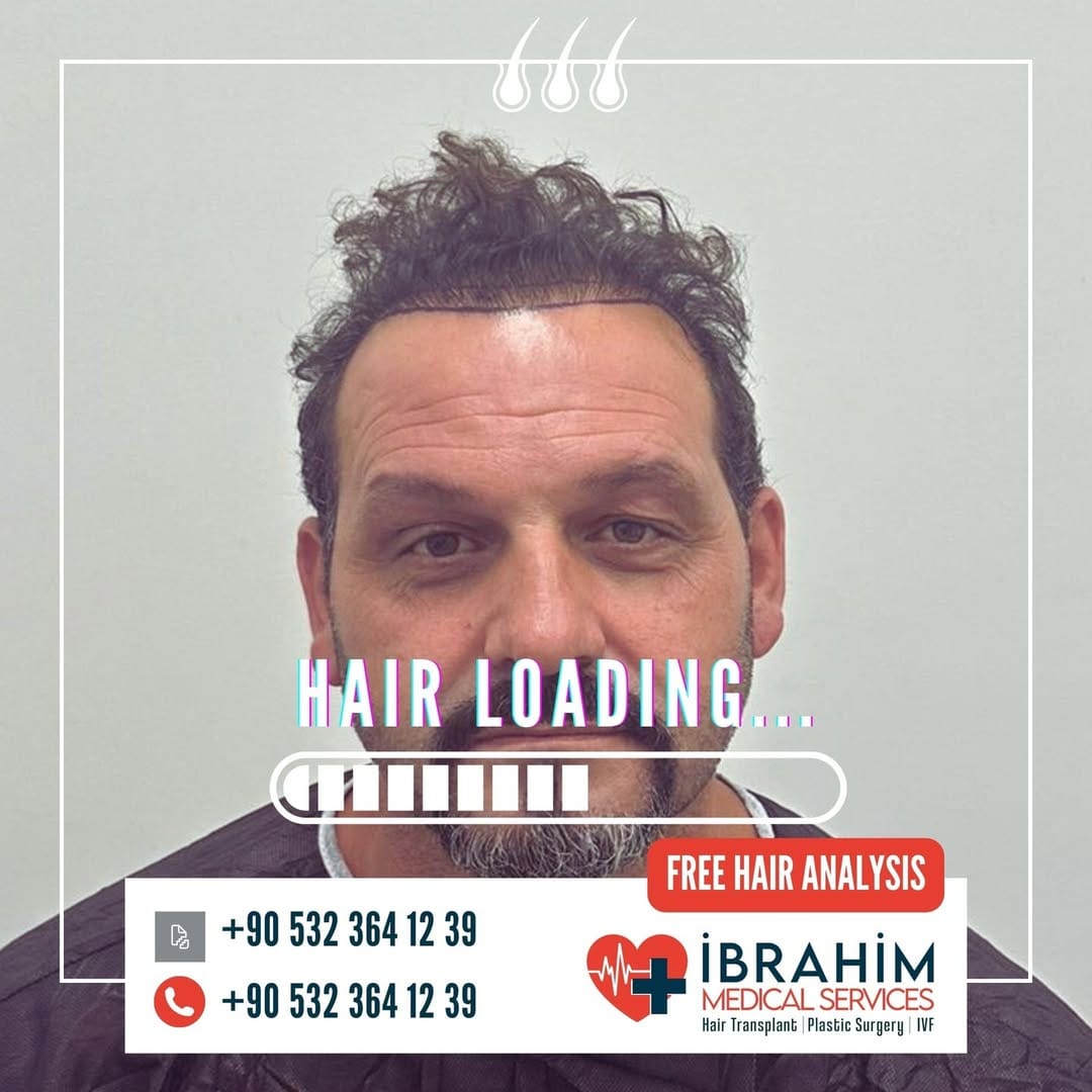 Post 4 by İbrahim Ayyıldız on Instagram (image)