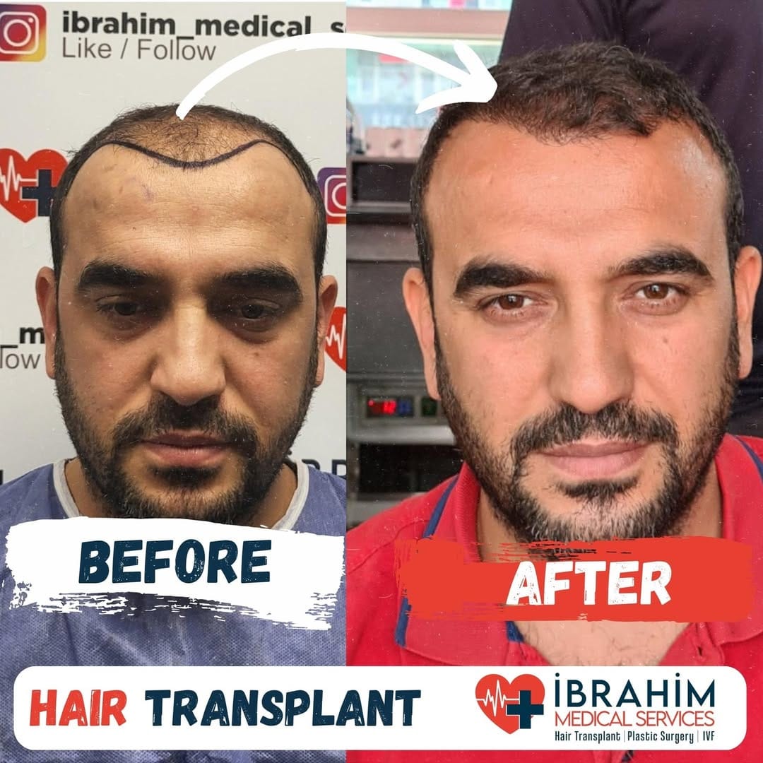 Post 9 by İbrahim Ayyıldız on Instagram (image)