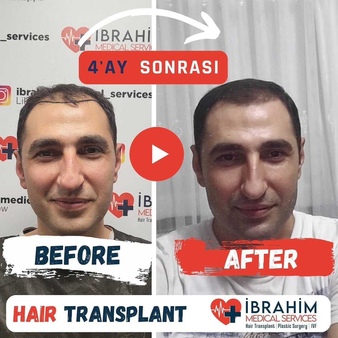 Post 6 by İbrahim Ayyıldız on Instagram (video)